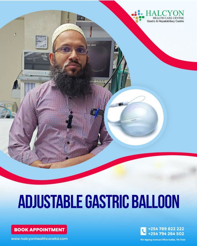 <strong style="color:#0c0b42;">Adjustable Gastric Balloon</strong> for Weight Loss
