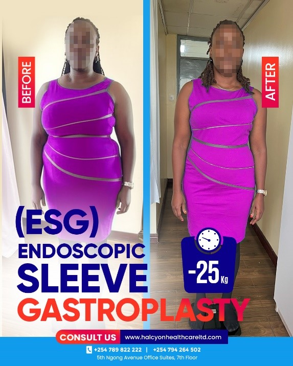 My ESG Transformation Story at Halcyon – Life after Losing 25kg