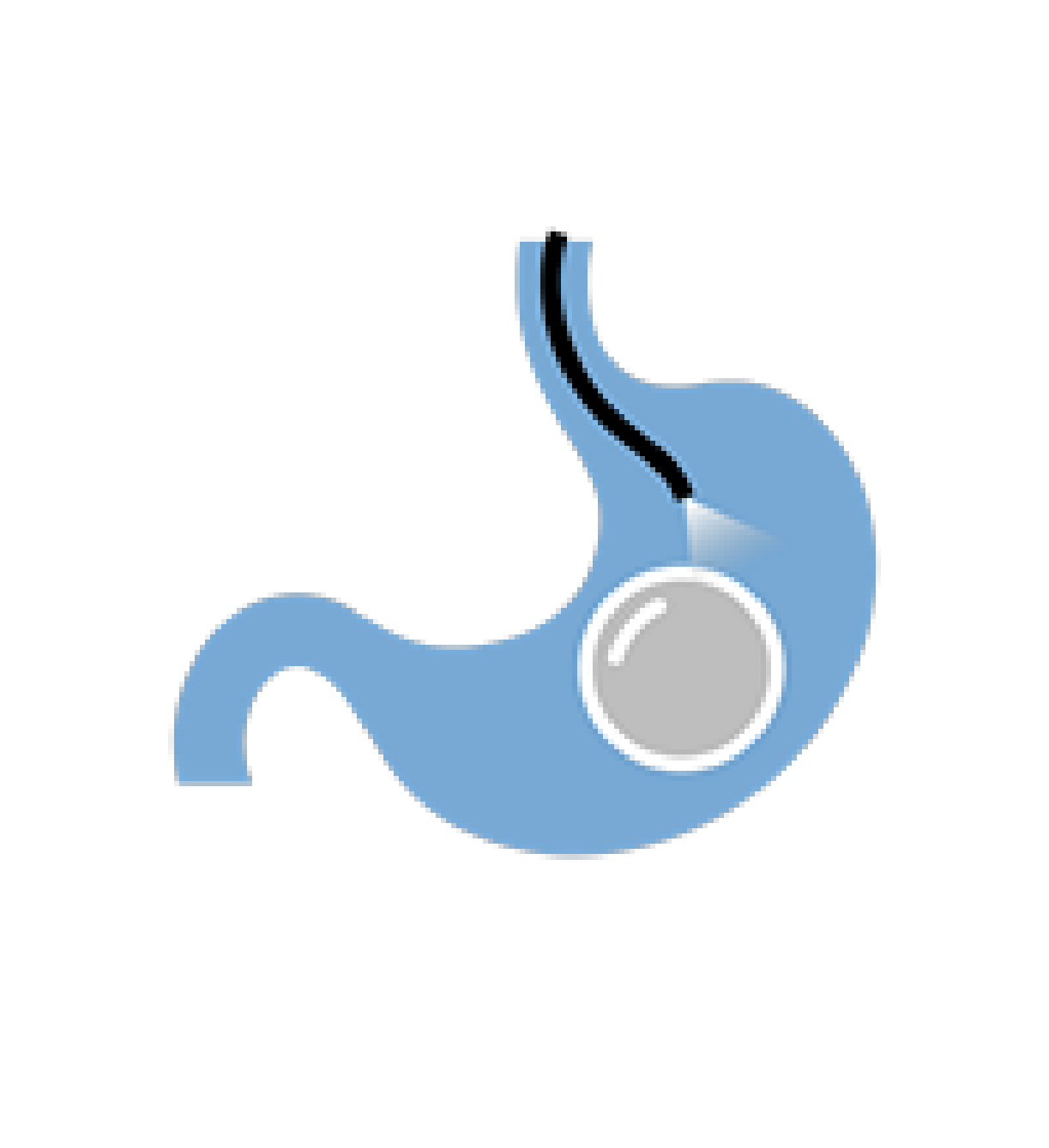 Endoscopic
